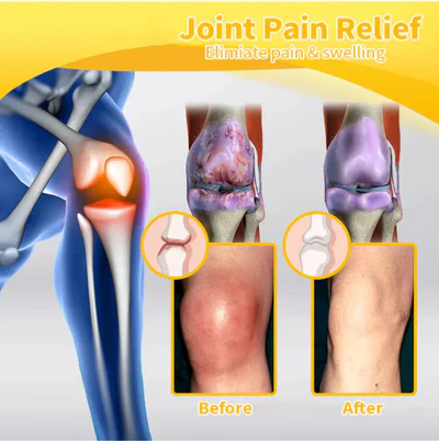 OSTEOARTHRITIS ARTHRITIS CREAM - NEW GENERATION JOINT PAIN TREATMENT GEL - Image 3