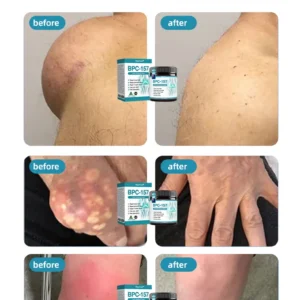 Joint Care Cream for Multiple Joints